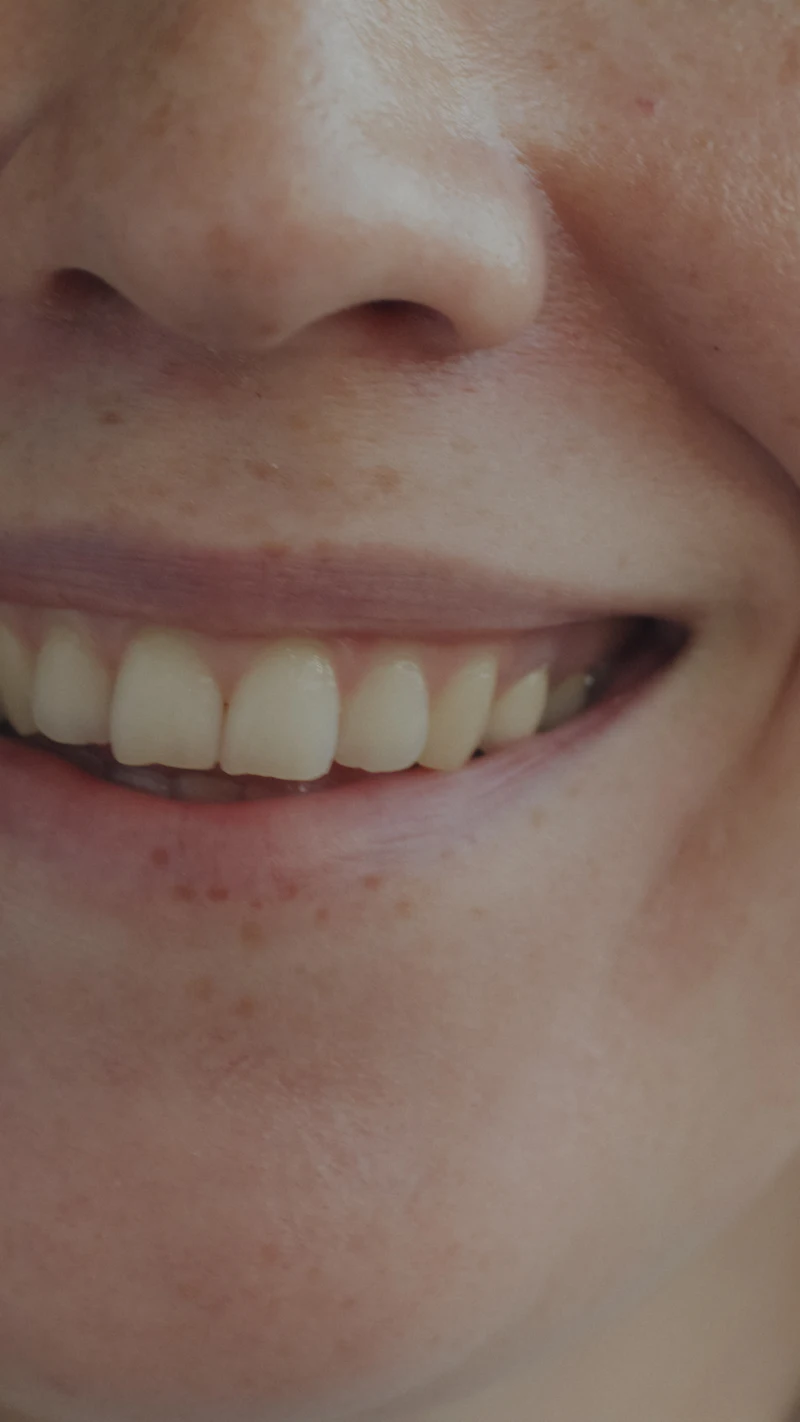 Close-up of a bright, even smile