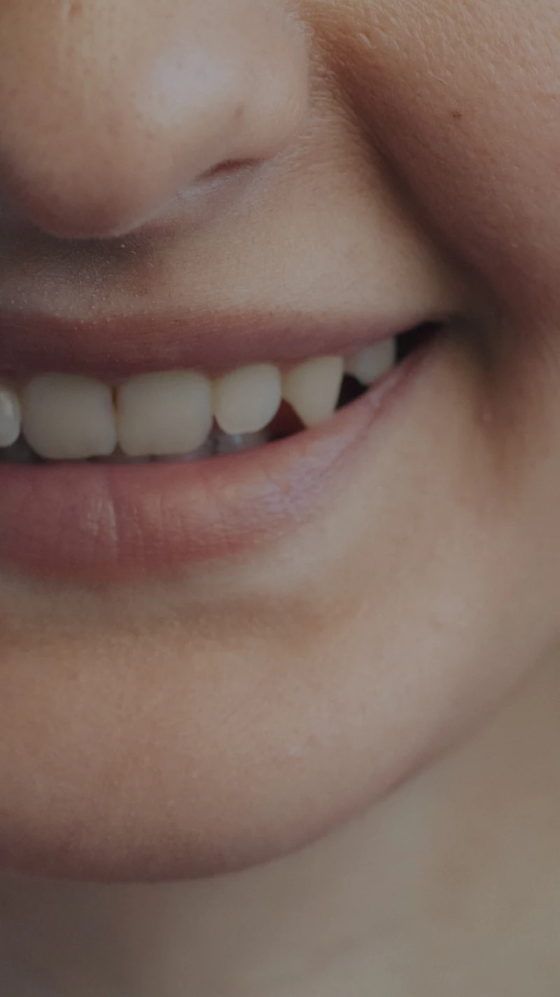 Close-up of a smile with a chipped front tooth