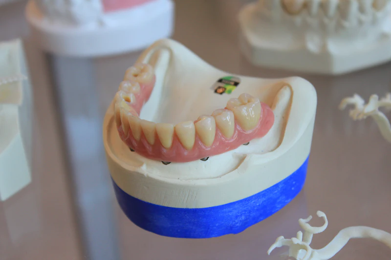 A lower denture sitting on a dental model