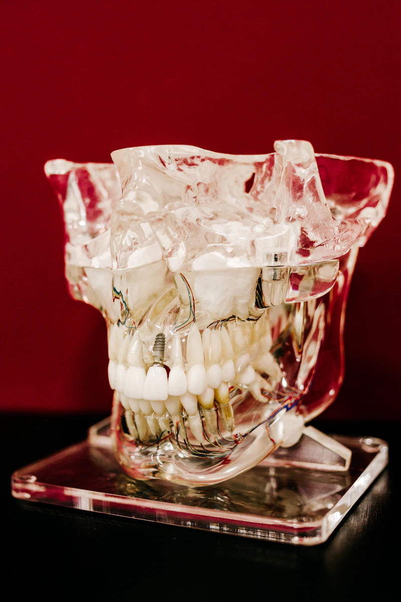 A clear teaching model of a jaw showing crowns and implant posts
